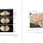 دانلود کتاب نورو آناتومی بالینی اسنل راین اسپلیت گربر pdf